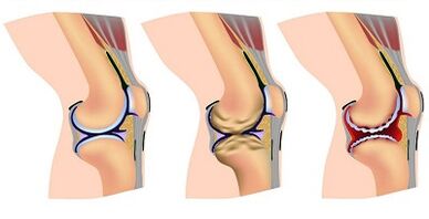 Development stages of knee joints