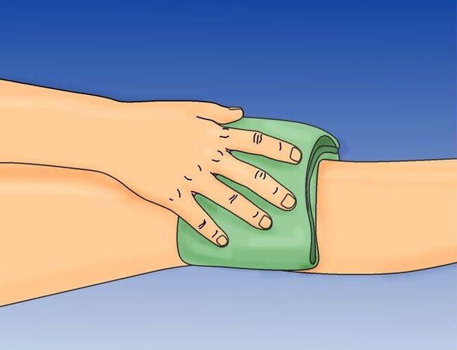 Compression to the knee for arthritis