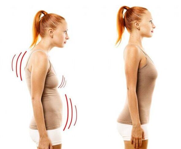 Correct and incorrect posture are the causes of chest cartilage degeneration