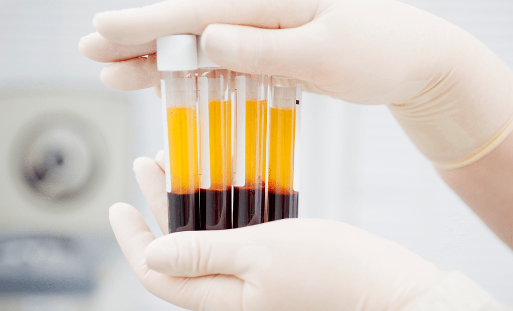 Platelet-rich plasma PRP treatment treats joint disease